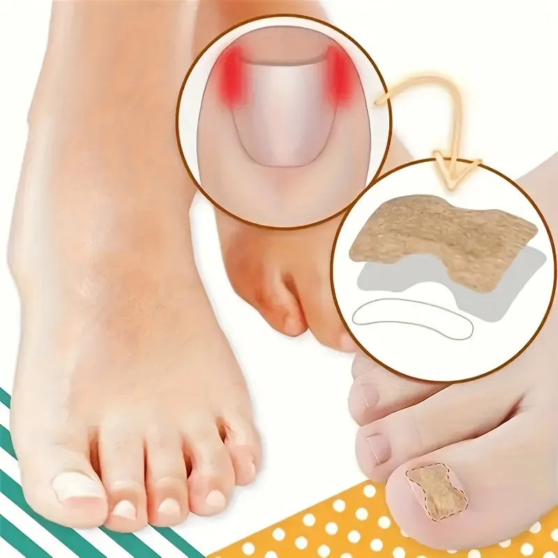 Fix Toenail Problems with 50 Nonadhesive Treatment Patches