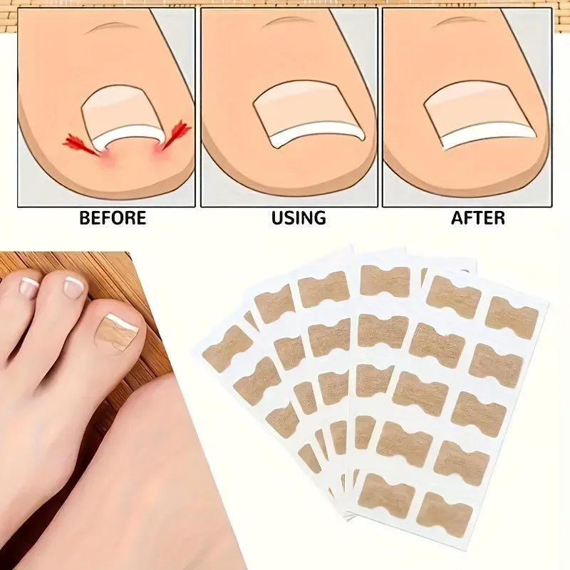 Fix Toenail Problems with 50 Nonadhesive Treatment Patches